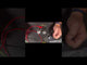 PatrolHideaway 360 Duo – 360° Hideaway LED Warning Light (A/W).